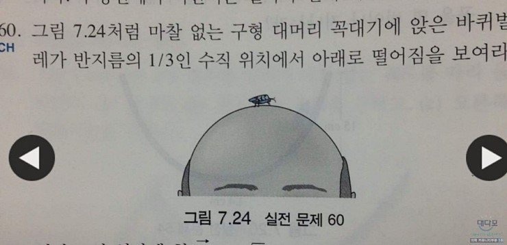 대머리2