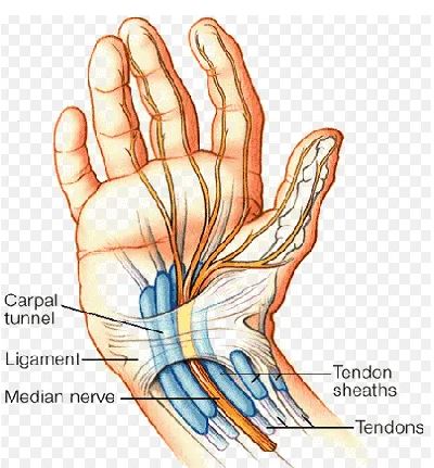 손목터널증후군(나무위키 사진자료)