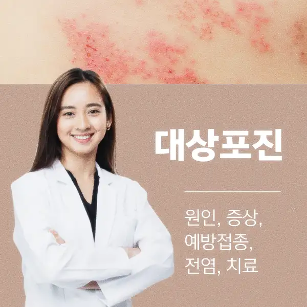 대상포진 원인&amp;#44; 증상&amp;#44; 예방접종&amp;#44; 전염&amp;#44; 치료