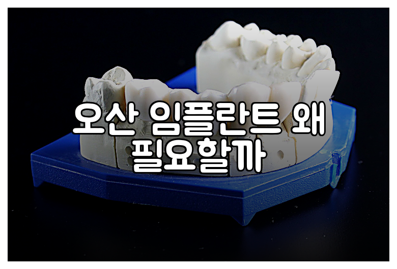 오산 임플란트 왜 필요할까