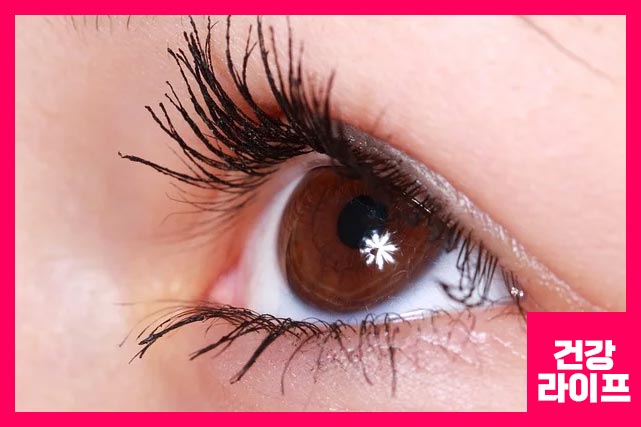 만성 눈떨림의 가장 흔한 경우인 양성 본태성 안검경련은 눈 주위의 경련과 근육 수축을 일으키는 신경 장애