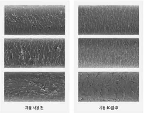 탈모샴푸-추천-바이오틴