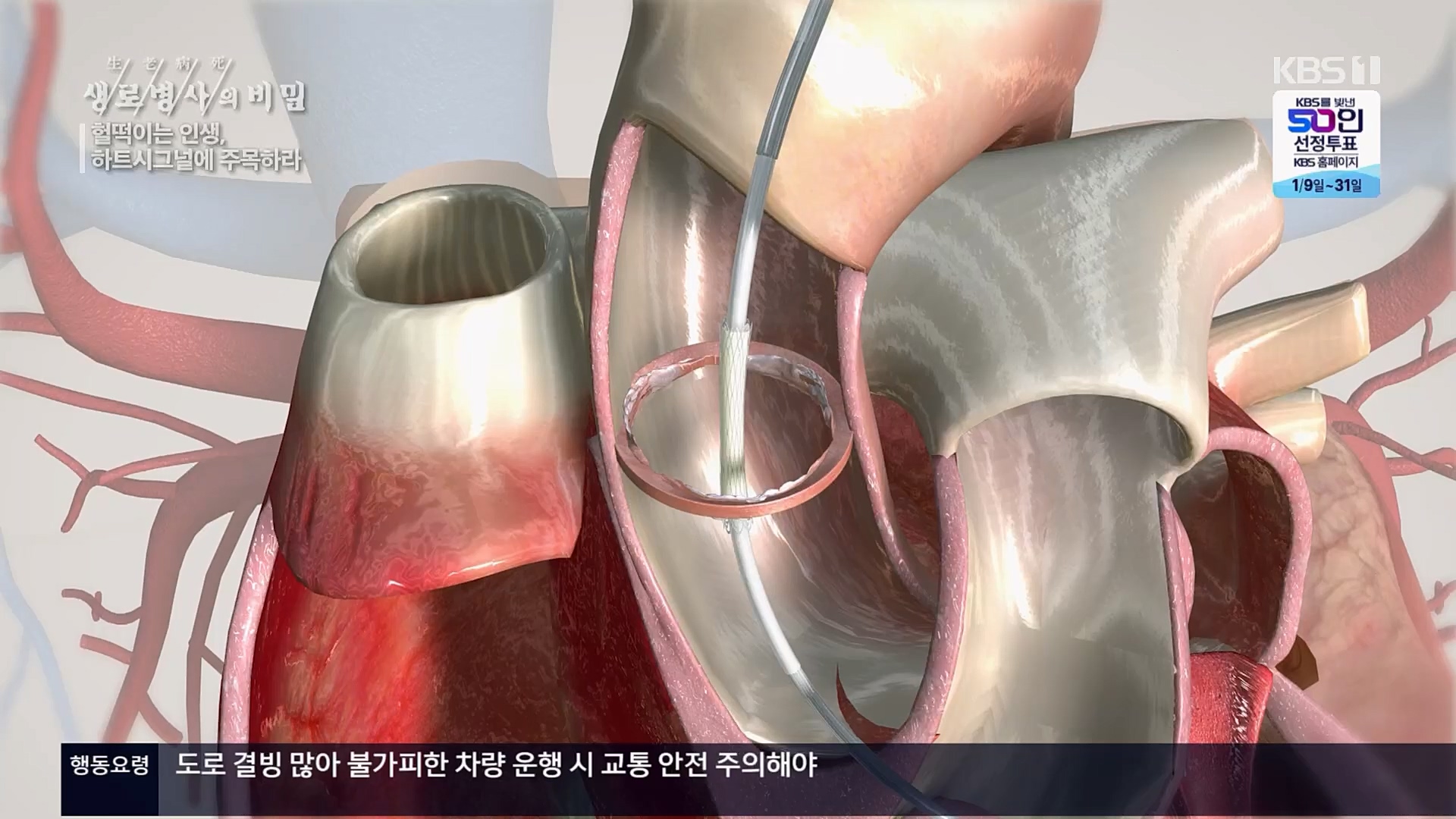 생로병사의 비밀.E853.230125p.H264-F1RST.mp4_20230210_203717.070.jpg