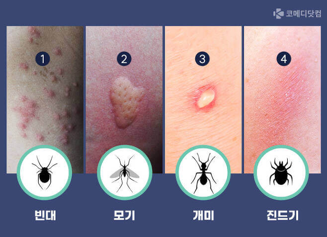 벌레 종류에 따른 물림 형태