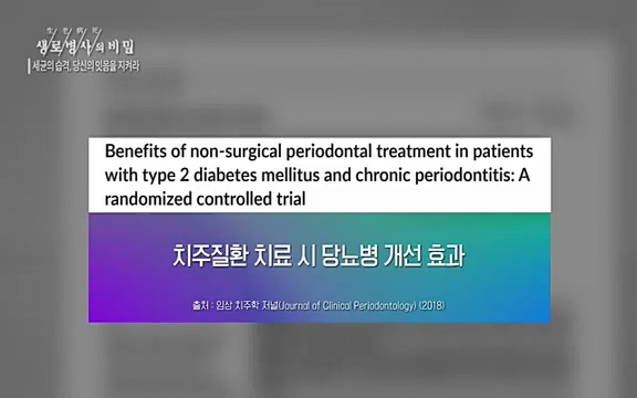 [792회] 생로병사의 비밀 - KBS[세균의 습격, 당신의 잇몸을 지켜라!] 감기보다 병원을 더 자주 찾게 만드는 질병이 있다. 바로 치주질환이다. 2020년 외래 다빈도 질병 1위를 차지한 치은염 및 치주질환 환자는 1,637_20220505_140653.336.jpg