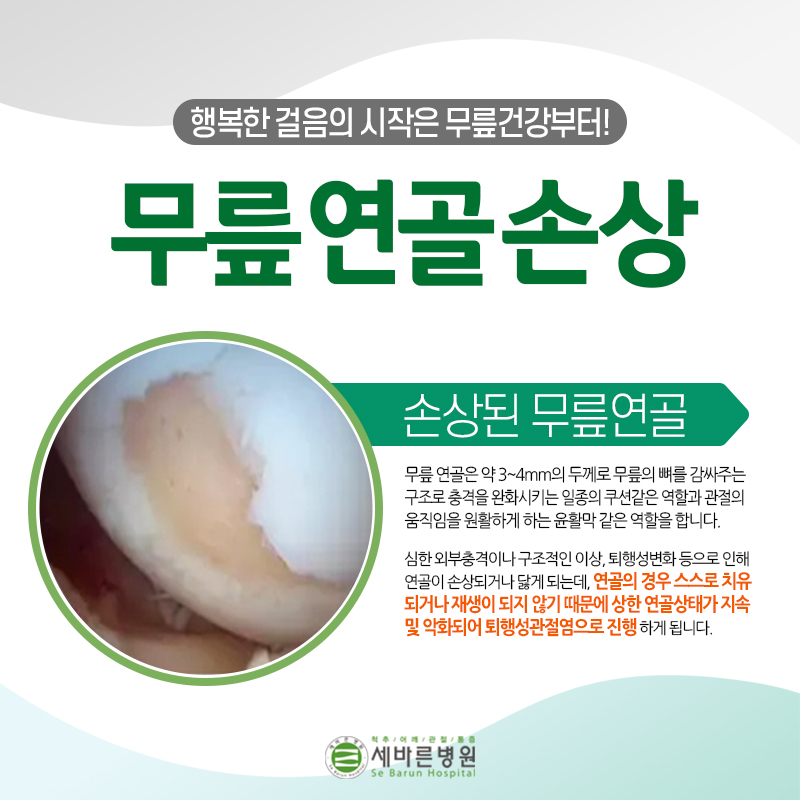 무릎연골손상 증상 원인 치료법