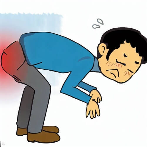  치질의 원인과 증상, 치질 종류에 따른 치료방법, 변비와의 관계는?
