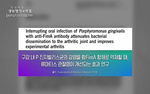 [792회] 생로병사의 비밀 - KBS[세균의 습격, 당신의 잇몸을 지켜라!] 감기보다 병원을 더 자주 찾게 만드는 질병이 있다. 바로 치주질환이다. 2020년 외래 다빈도 질병 1위를 차지한 치은염 및 치주질환 환자는 1,637_20220505_140823.014.jpg