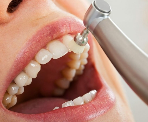 일어나자 마자 양치질?...누구나 고민하는 아침 양치질 시기 ㅣ 스켈링 시기 How Often Should You Have a Dental Cleaning?
