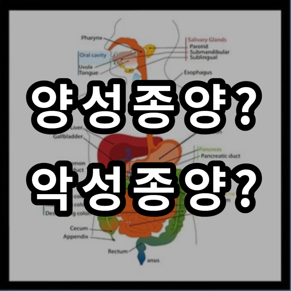  양성종양? 악성종양? 진단과 치료를 통한 예방