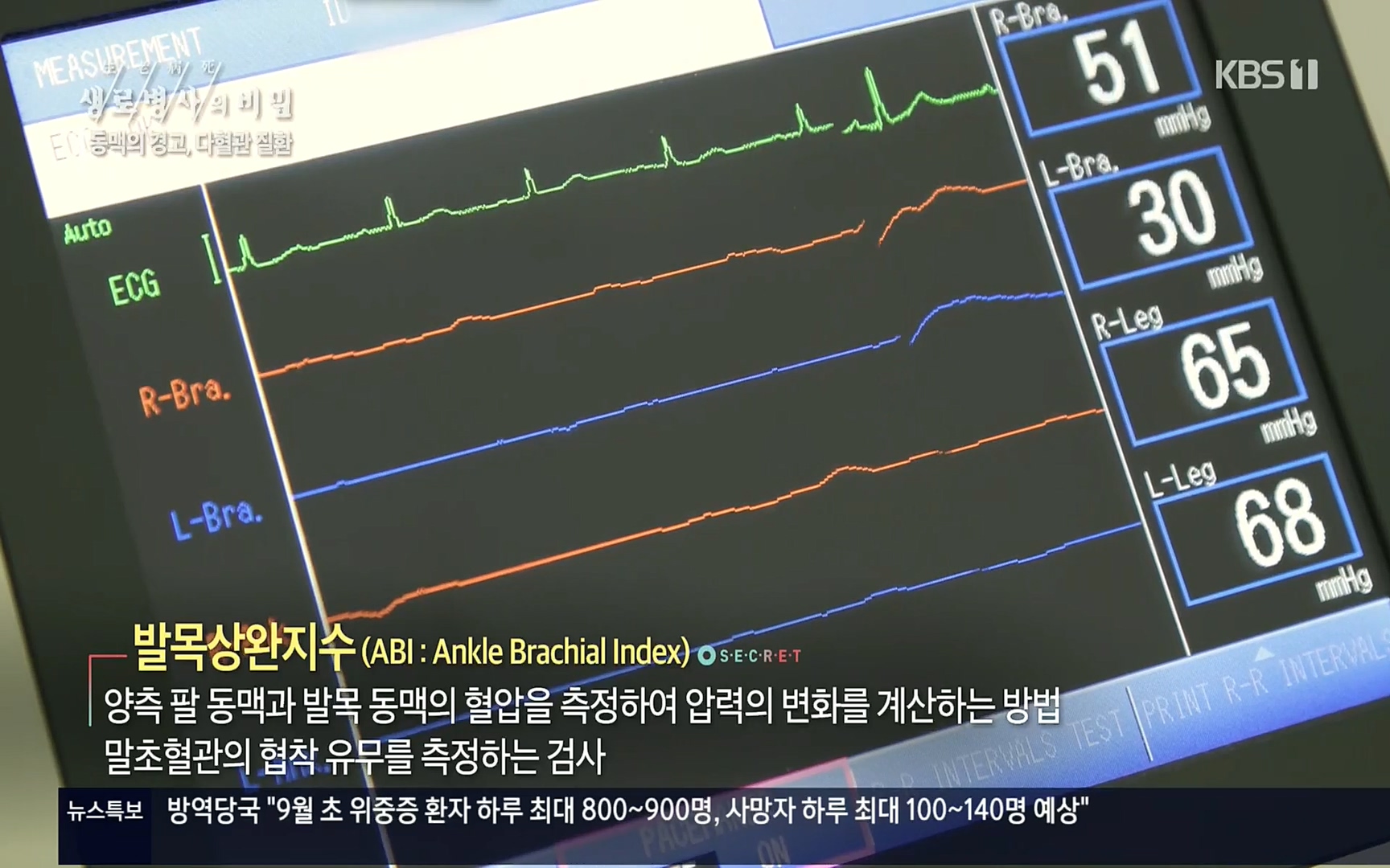 생로병사의 비밀.E831.220817p.H264-F1RST.mp4_20220822_184603.333.jpg