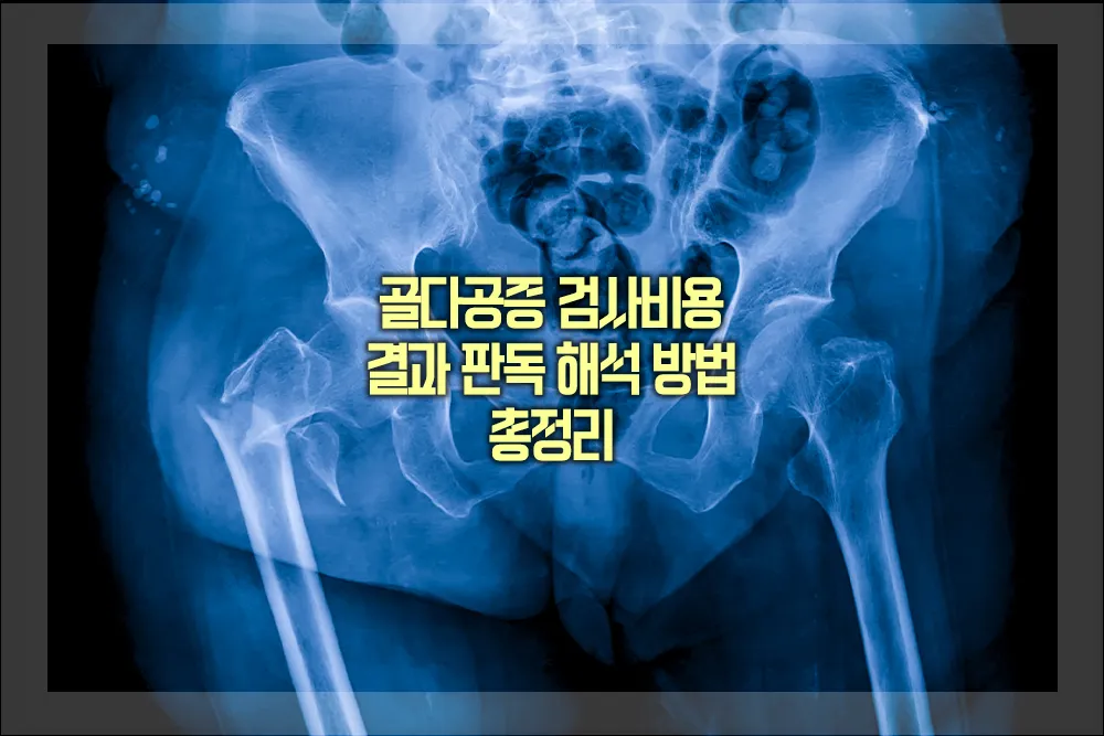 골다공증 검사비용