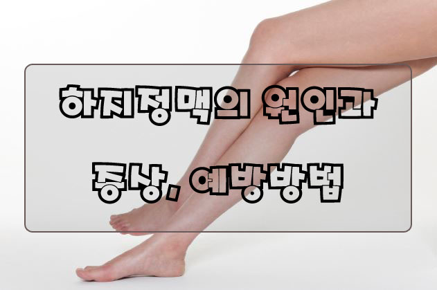  하지정맥류 원인과 예방방법.
