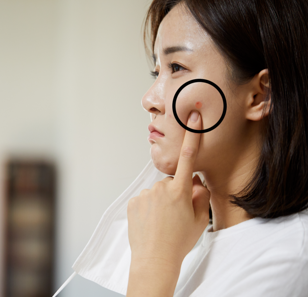  피부에 빨간점 발견했다면? 제발 꼭 읽어보세요