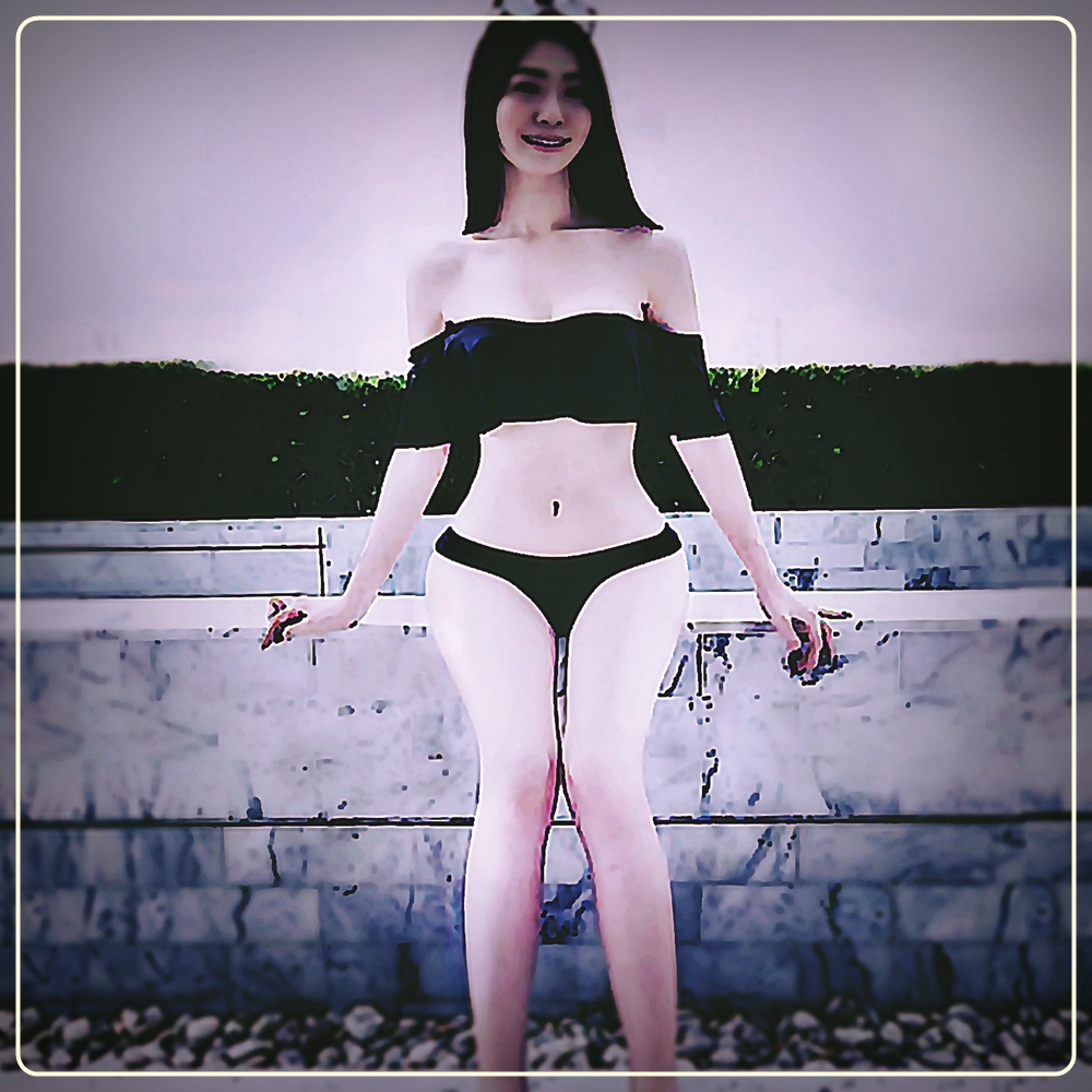  엉덩이성형후기+가슴재수술 고민할때 보형물 대신 바디필러 효과 및 부작용 정보