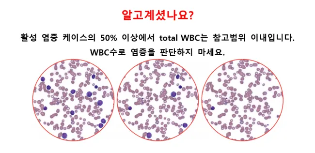 호중구 정상수치