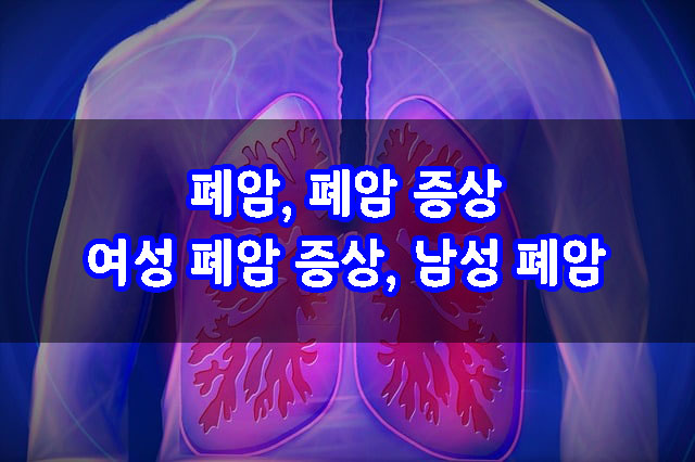  폐암, 폐암 증상, 여성 폐암 증상, 남성 폐암 차이