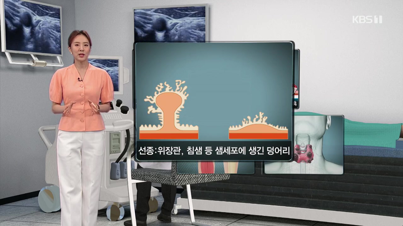 생로병사의 비밀.E870.230532p.H264-F1RST.mp4_20230605_195521.681.jpg