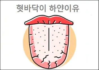 혓바닥이 하얀이유