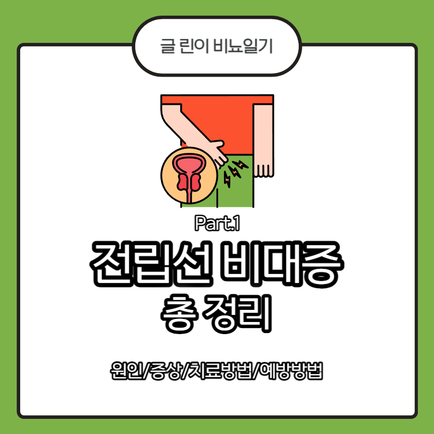  전립선 비대증 총 정리 Part.1 : 원인/증상/치료방법/예방방법