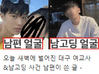  (사진O) 대구 여교사 남학생 사건요약, 인스타, 난소낭종 파열