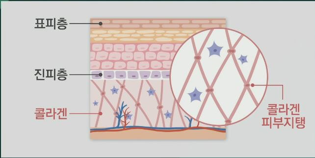 콜라겐 피부