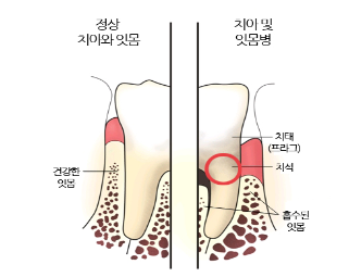  스케일링,가격/주기 총 정리
