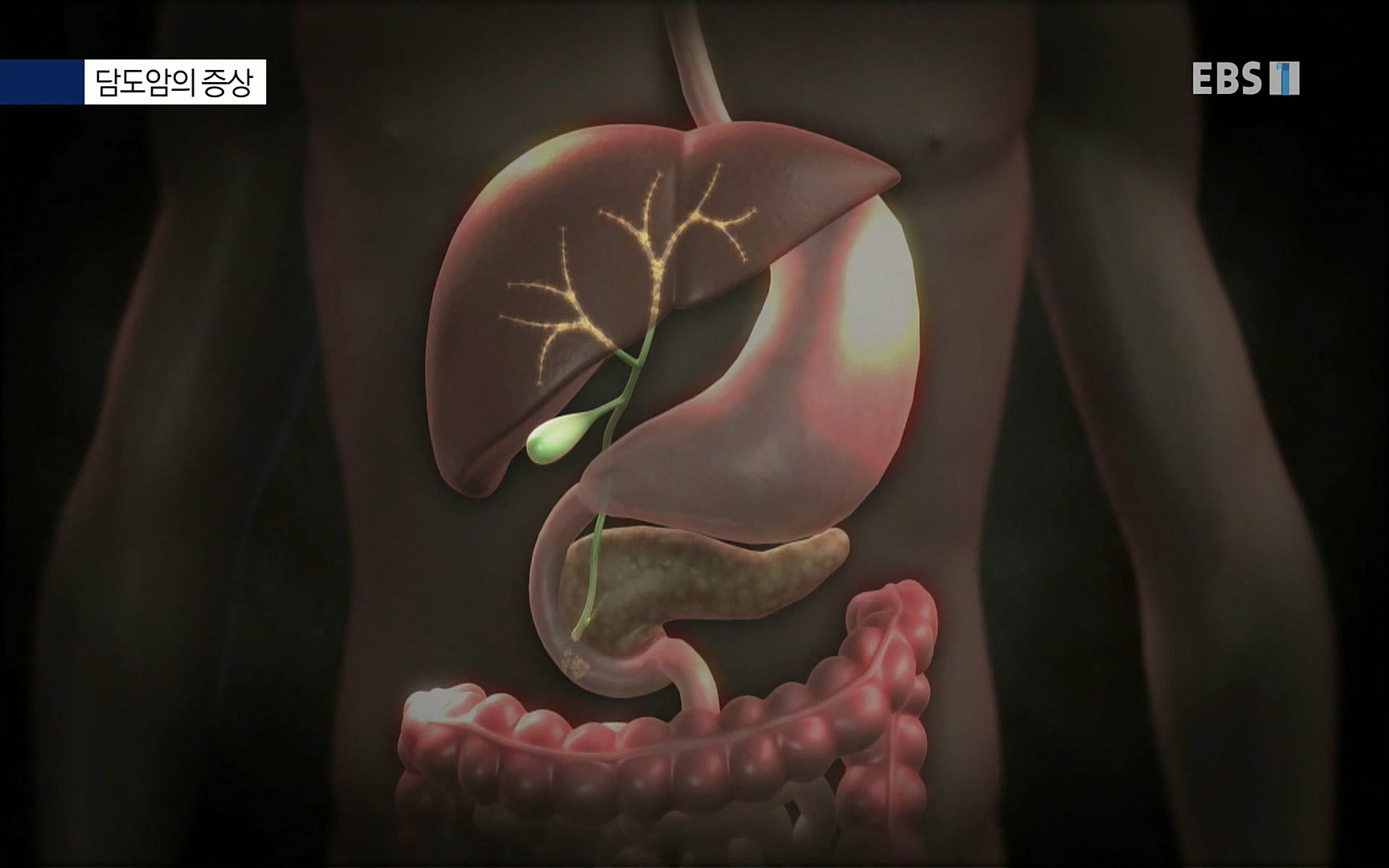 EBS 명의 헬스케어 - TV - 교육의 중심 EBS[명의 스페셜] 공포의 암, 췌장암, 담도암, 담낭암.mp4_20220902_210918.619.jpg