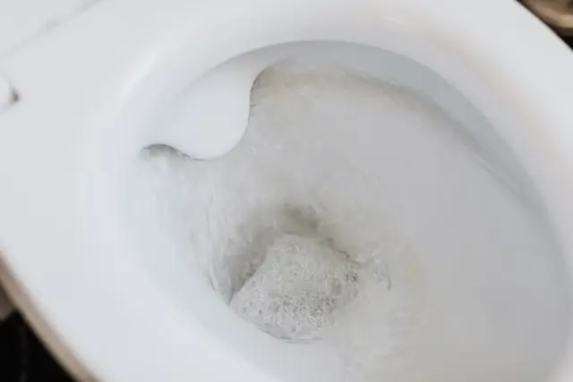 흰색 변, 붉은색 변, 검은색 변이 생기는 이유는?
