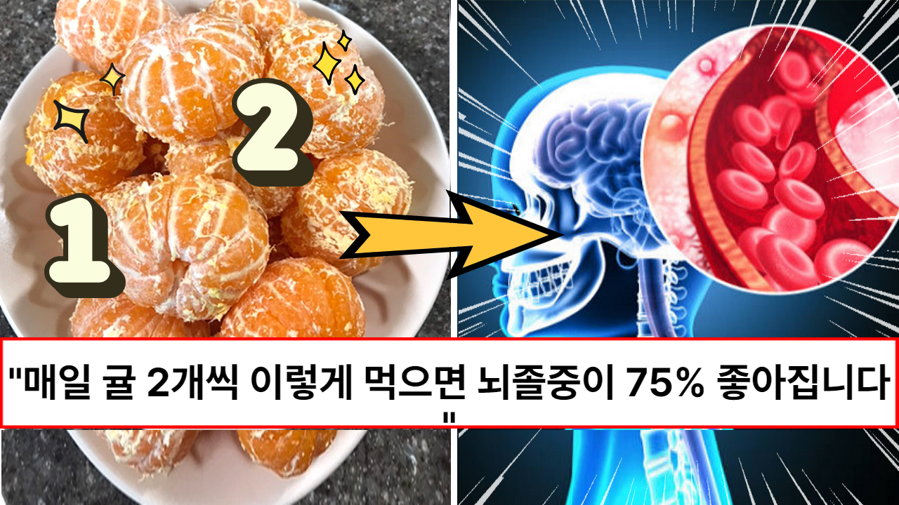 “다리 아픈 분들은 무조건 드세요” 돌연사를 막아주고 뇌졸중을 75% 막아주는 귤 먹는 방법