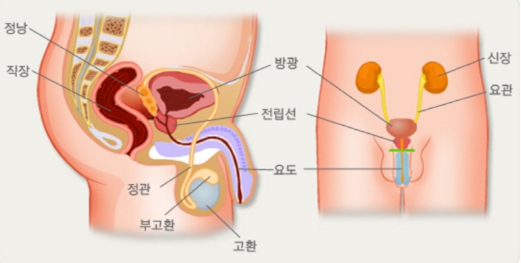 전립선염 증상