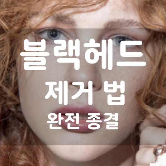  블랙헤드 제거 방법 추천, 이것으로 완전 종결!