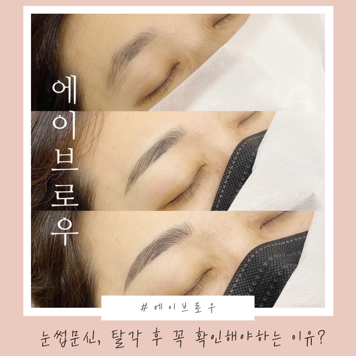  천안반영구 화장 탈각 후 꼭 확인하세요!
