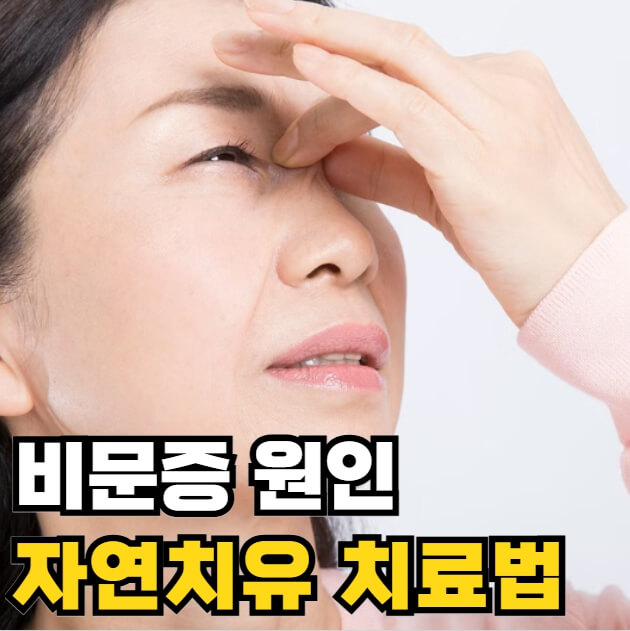 비문증 원인 자연치유 치료방법