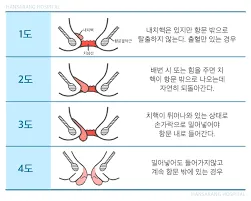 항문에서 피가나는 이유