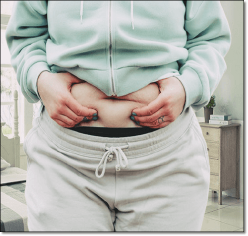 당뇨병성 신경병증에 걸리기 쉬운 비만 여성