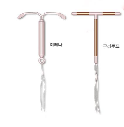  일시적인 피임법 - 자궁내 장치와 임플라논