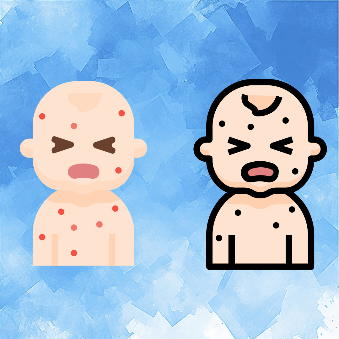 돌발진 증상 그림