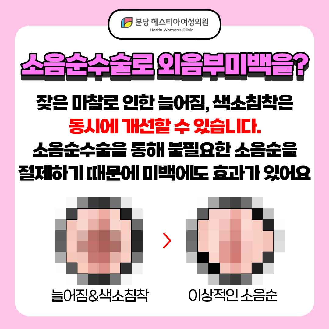 서현 소음순수술 외음부미백 생식기 통증 외음부미백 소음순수술로 가능하다?