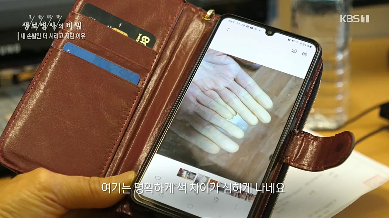 생로병사의 비밀.E847.221215p.H264-F1RST.mp4_20221215_202307.206.jpg