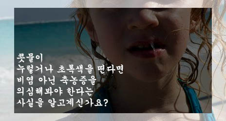  콧물이 누렇거나 초록색을 띤다면 비염 아닌 축농증을 의심해봐야 한다는 사실을 알고계신가요?