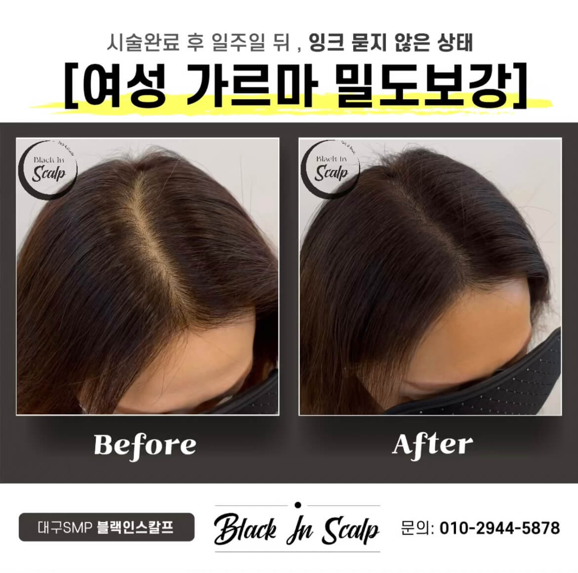 블랙인스칼프 이미지