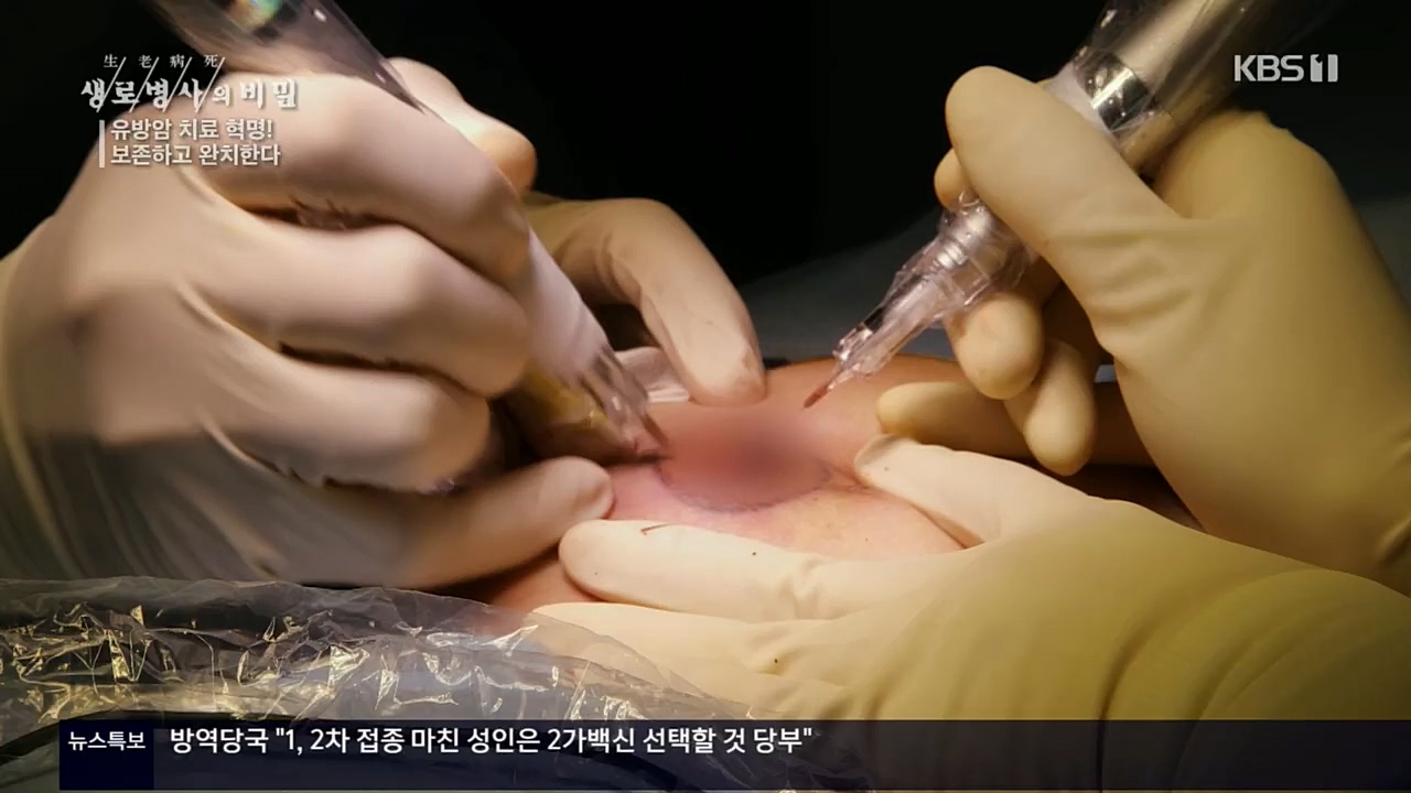 생로병사의 비밀.E845.221131p.H264-F1RST.mp4_20221201_215311.180.jpg