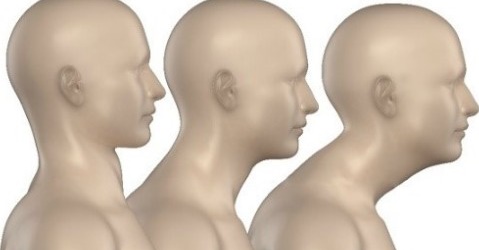  거북목 증후군 증상 교정에 좋은 운동 및 스트레칭 방법 입니다.