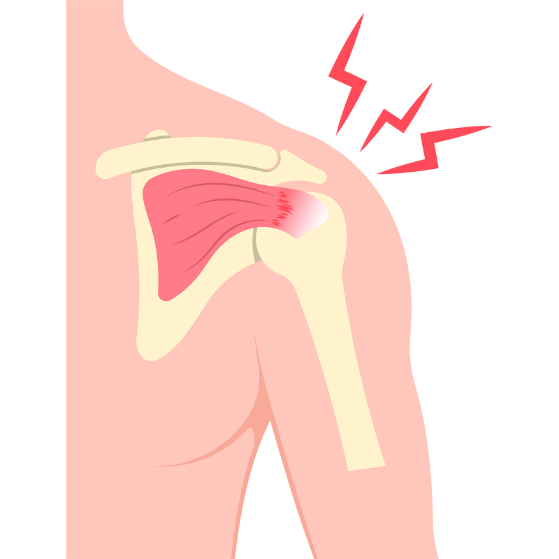 어깨 통증 원인 증상 치료법