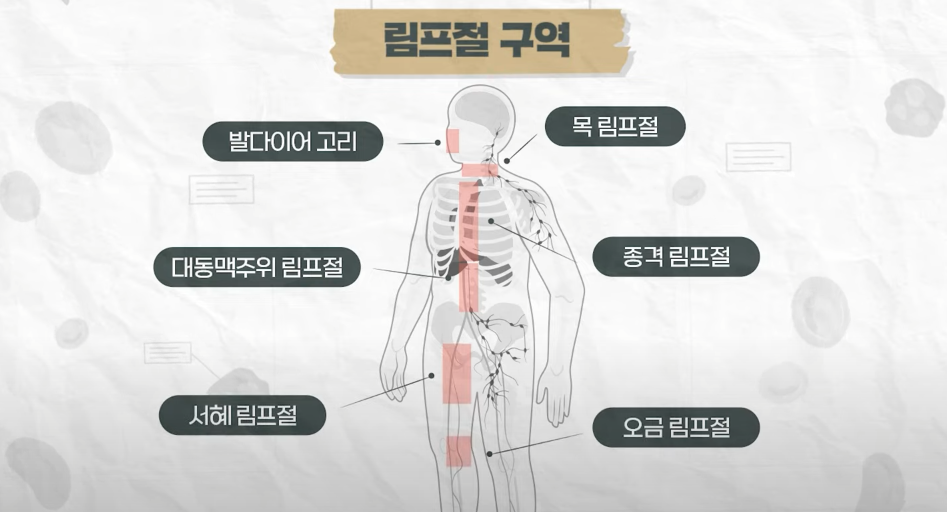  혈액암 림프종 치료하면 생존률 높일 수 있습니다