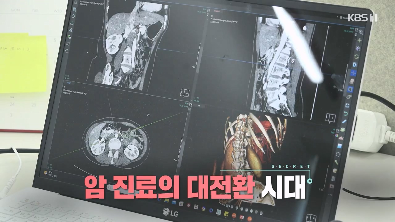 생로병사의 비밀.E881.230831p-NEXT.mp4_20230901_221756.422.jpg