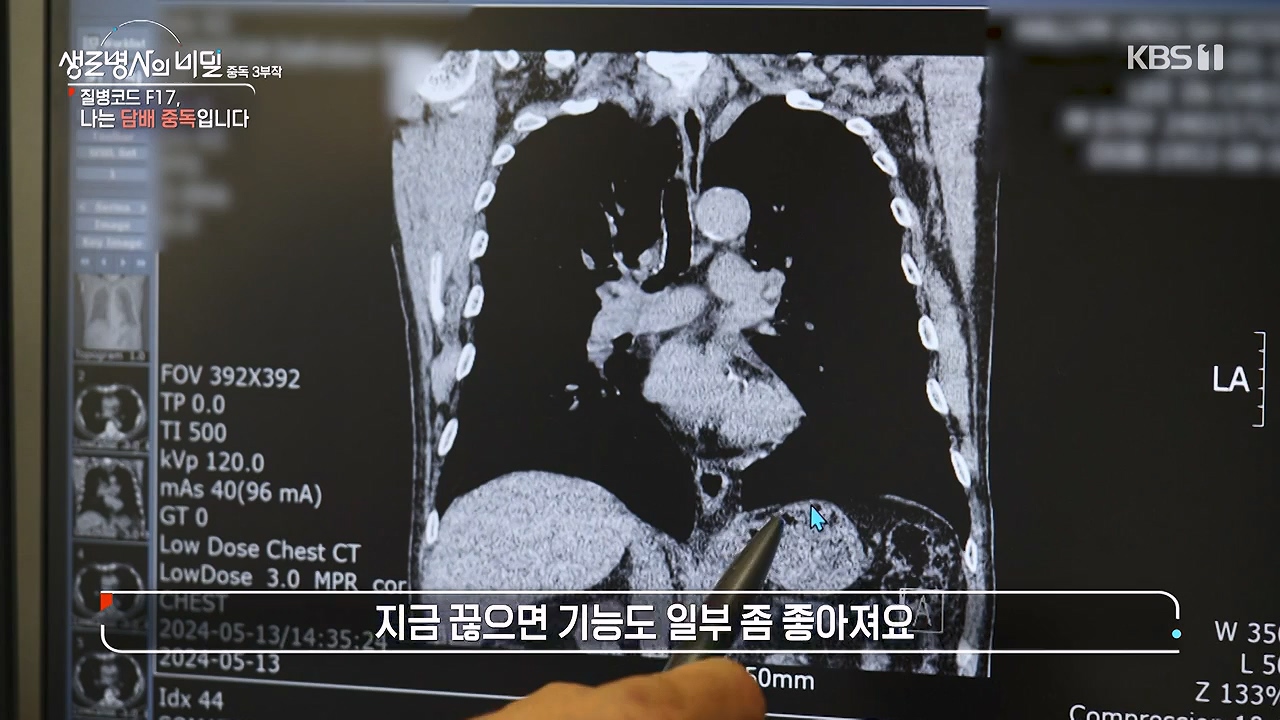 생로병사의 비밀.E916.240620p-NEXT.mp4_20240620_200636.284.jpg