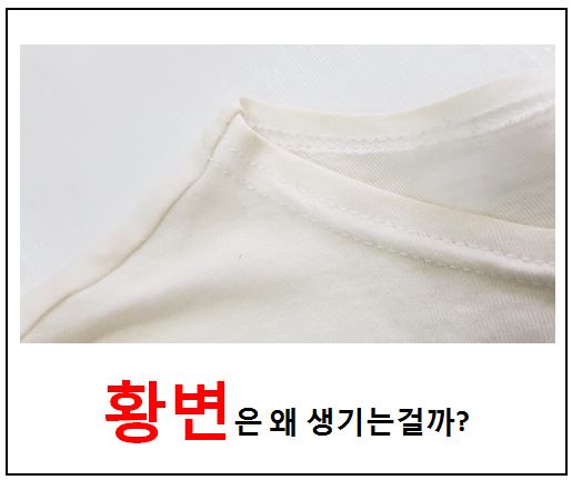  의류 황변의 원인 및 대책