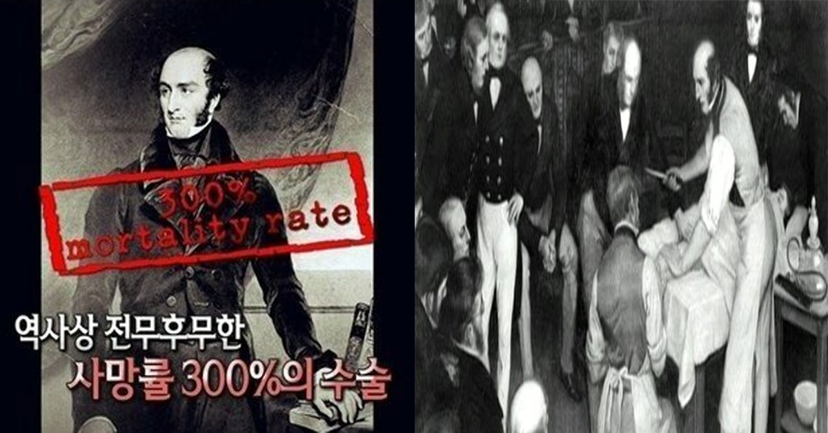  1명이 수술했는데, 3명이 사망한 '사망률 300%'를 기록한 사건 ㄷㄷ